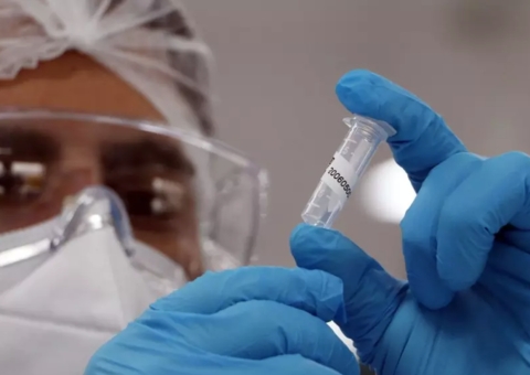 Amazonas registra 305 novos casos e 19 óbitos por covid-19