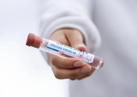 Amazonas registra 957 novos casos de Covid em 24 horas