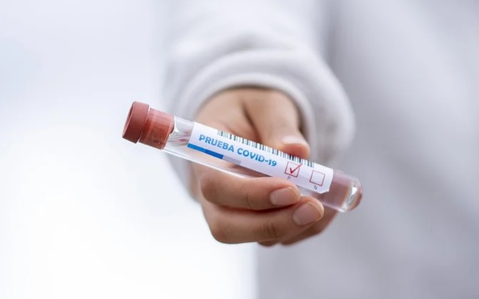 Amazonas registra 957 novos casos de Covid em 24 horas