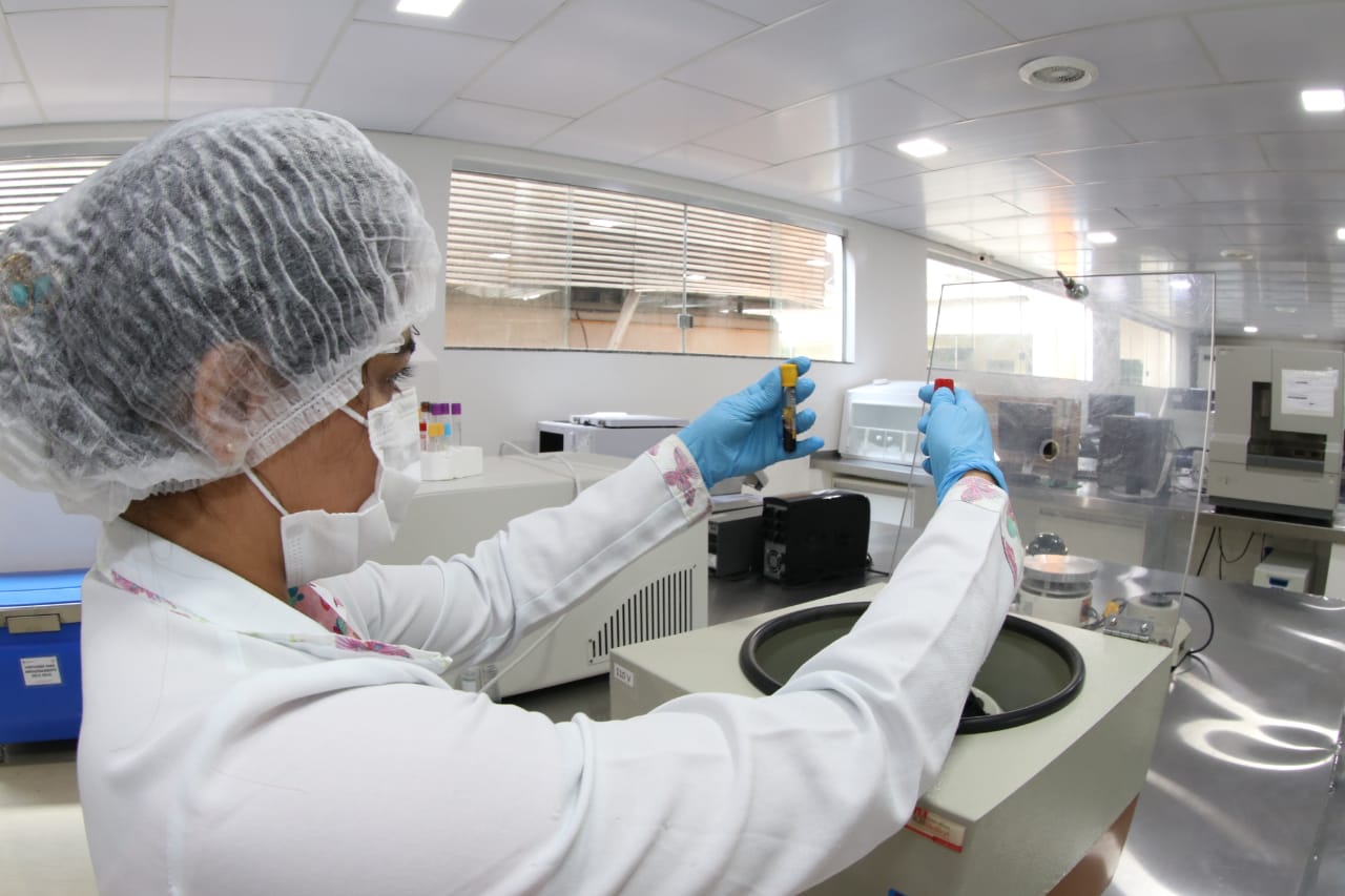 Estudo caracteriza mecanismos inflamatórios relacionados à tuberculose