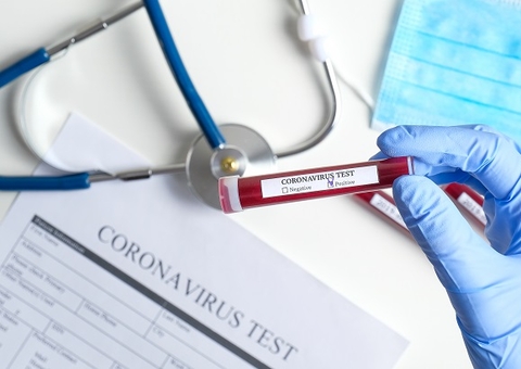 FVS-AM se pronuncia sobre brasileiros com variante do coronavírus no Japão