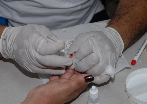 Amazonas tem quase 160 mil casos confirmados de Covid-19