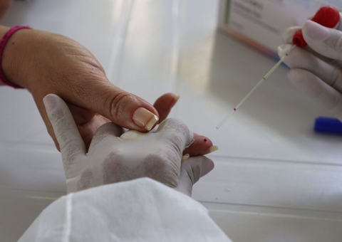 Amazonas chega a 173.346 casos de Covid-19