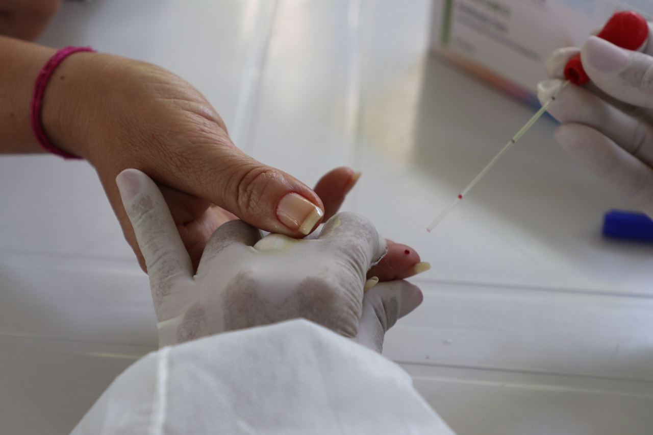 Amazonas chega a 173.346 casos de Covid-19