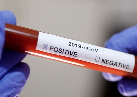 Amazonas tem pelo segundo dia mais de 800 novos casos de Covid em 24 horas