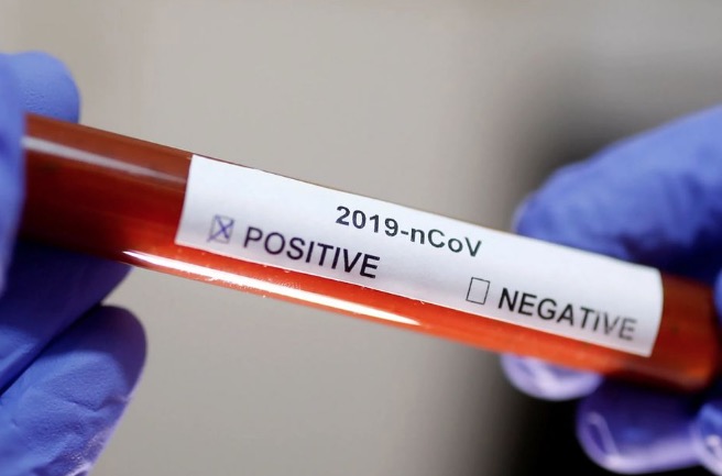 Amazonas tem pelo segundo dia mais de 800 novos casos de Covid em 24 horas