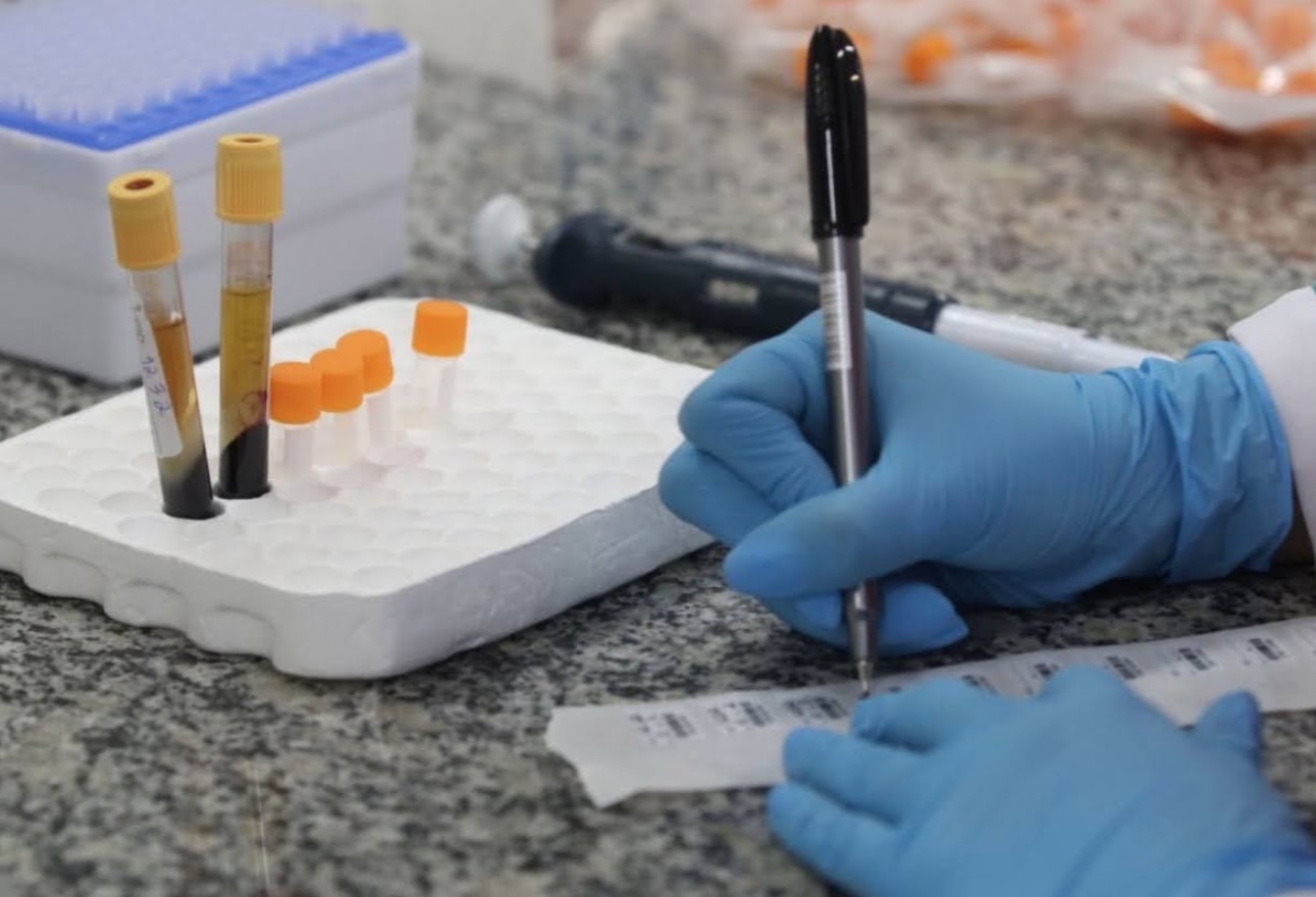 Estudo descarta relação entre tipo sanguíneo e mais chances de ter covid-19