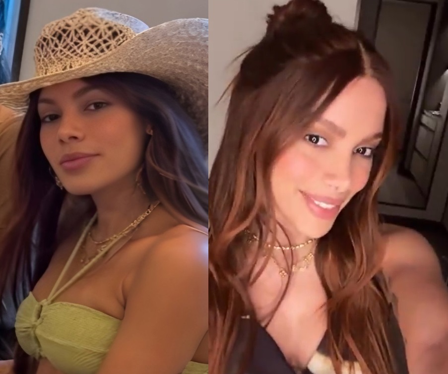 Anitta revela quais procedimentos realizou após surgir com 'rosto novo'