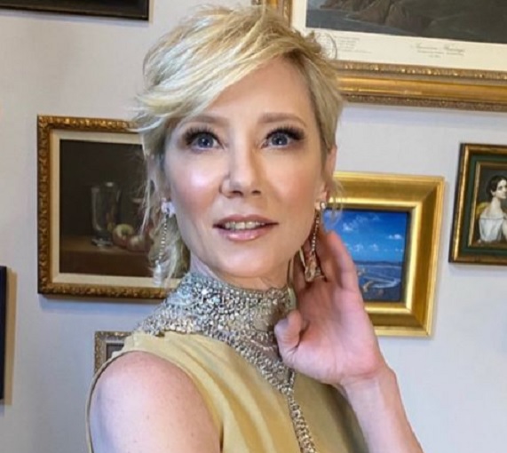 Anne Heche ficou presa em carro em chamas por 45 minutos antes de resgate