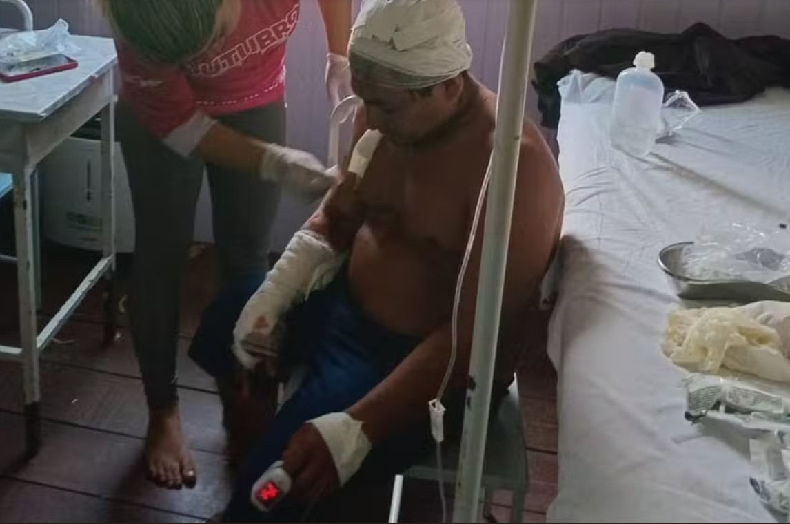 Cacique é atacado por onça no Amazonas