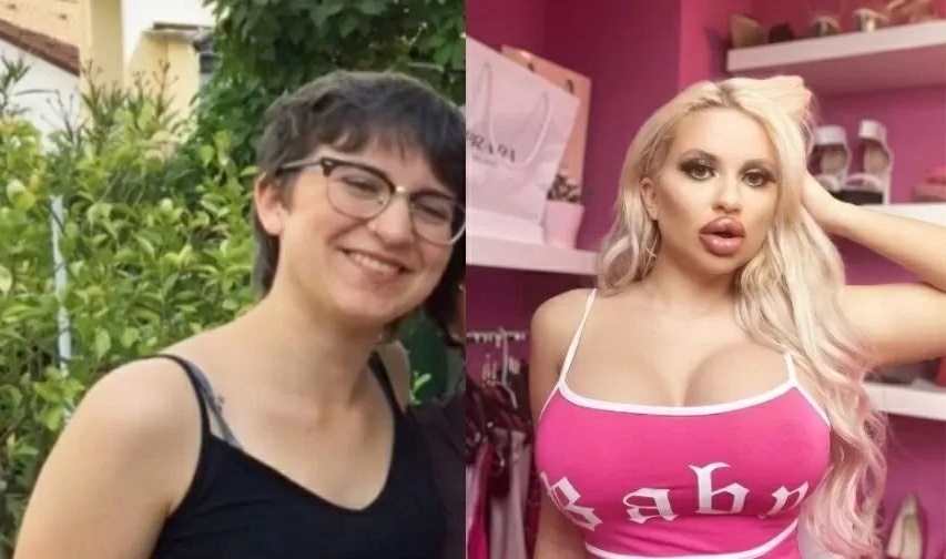 Jovem gasta R$ 180 mil em plásticas para ficar parecida com a Barbie