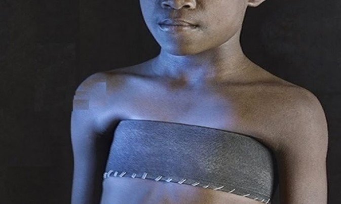 Meninas africanas sofrem torturas nos seios para evitar atração masculina