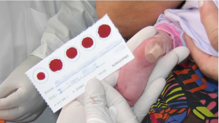 Mais de 60 bebês são identificados com anticorpos contra Covid-19 no Brasil