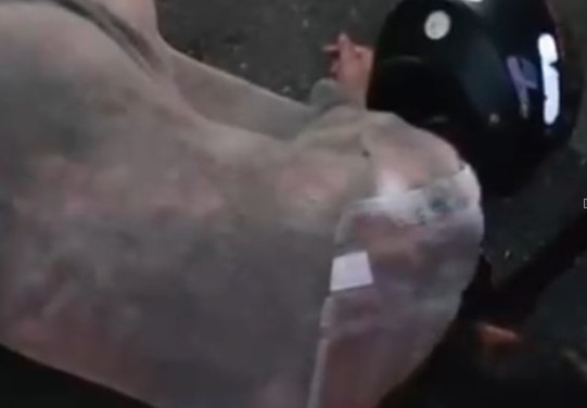 Passageira de moto por aplicativo fica gravemente ferida em acidente em Manaus