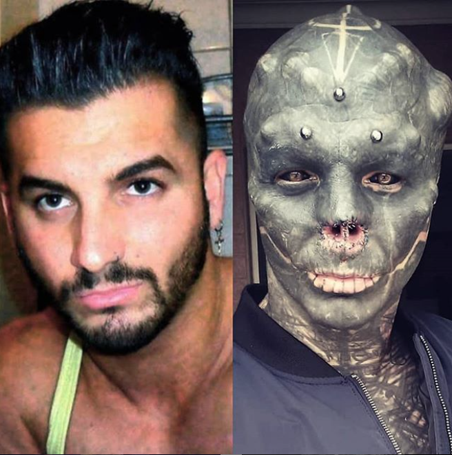 Após tirar orelhas, homem remove parte do nariz para parecer com alienígena