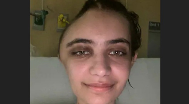 Mulher fica com cabeça deformada ao após cadeira cair de prédio