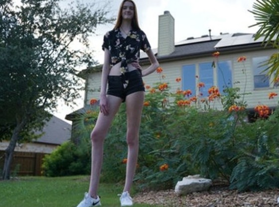 Conheça Maci, a adolescente com as pernas mais longas do mundo