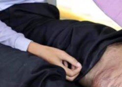 Homem fica com perna deformada após picada de mosquito: 'pata de elefante'