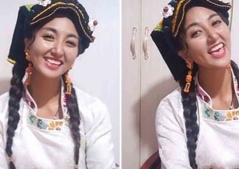 Queimada ao vivo por ex-companheiro, influencer morre após dias internada