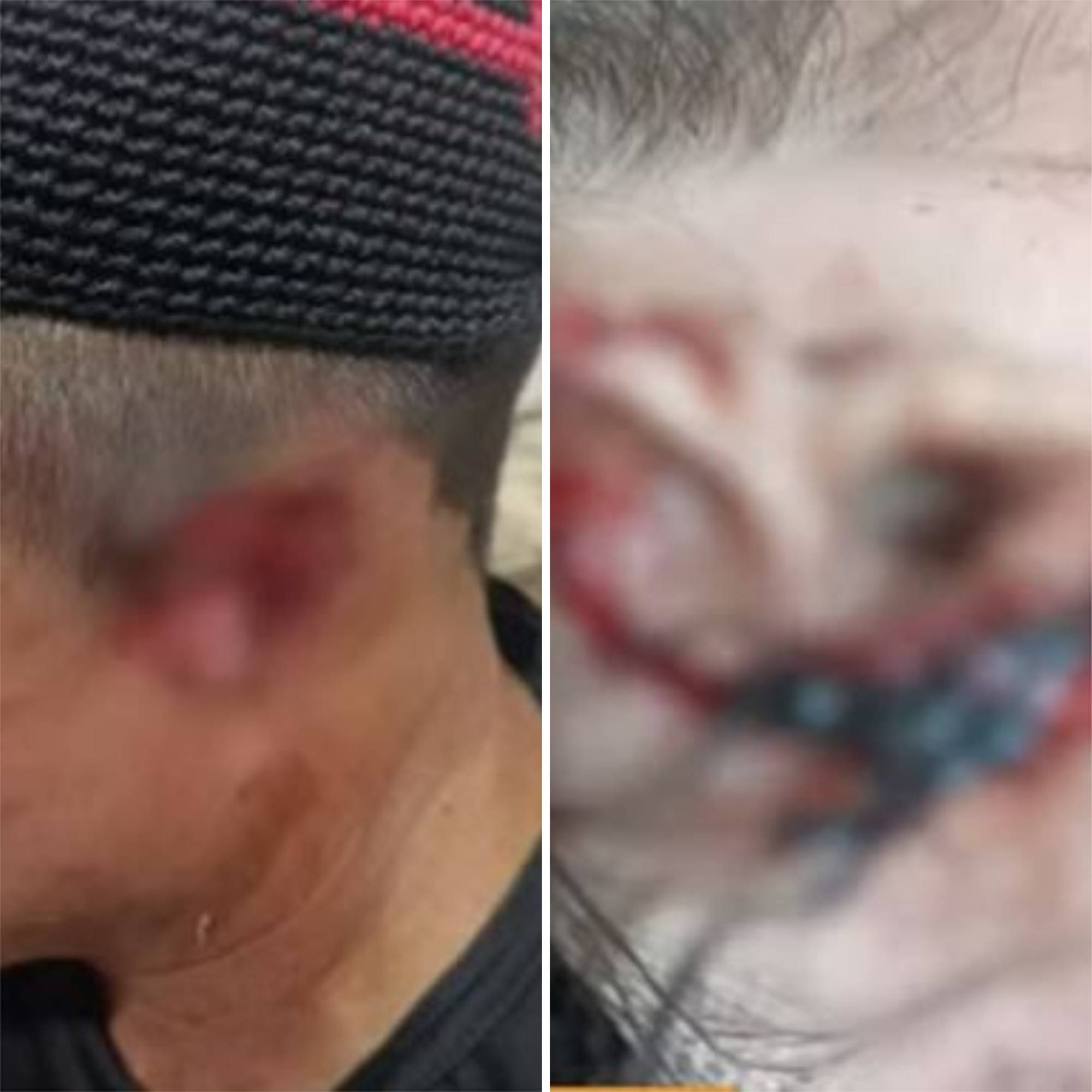 Casal indígena tem orelhas cortadas por membros de facção em Parintins