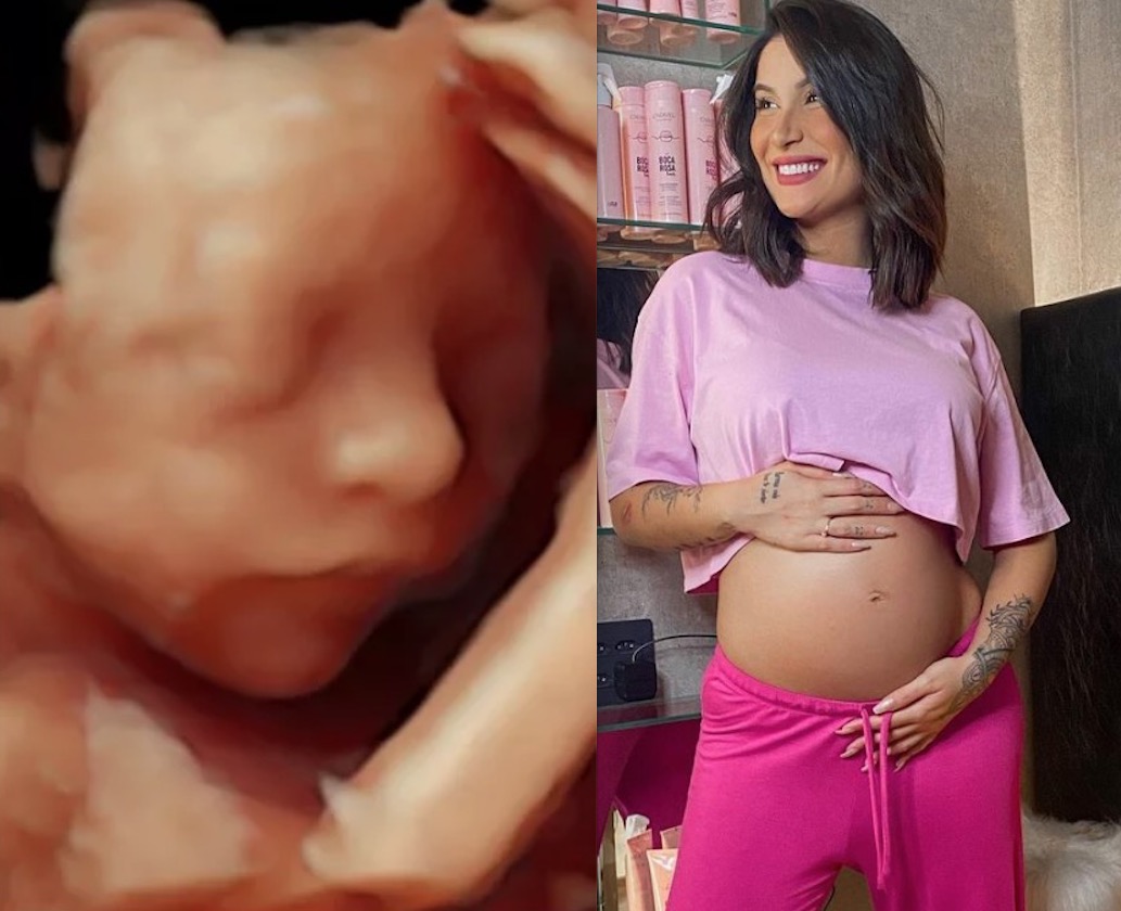 Bianca Andrade mostra rostinho do filho em ultrassom