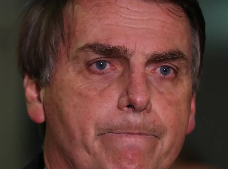 Bolsonaro passará hoje por novo procedimento para conter crises de soluço