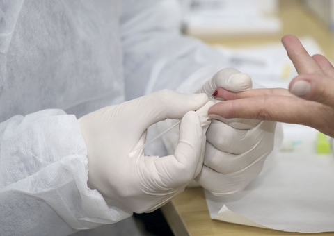 Brasil registra 23.439 novos casos de Covid e 636 mortes em menos de um dia