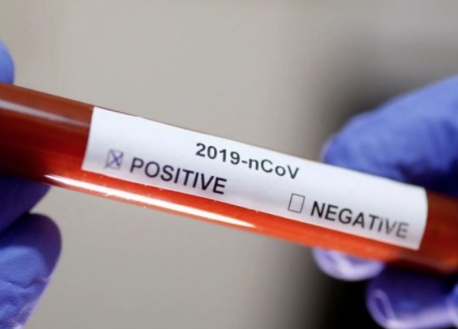 Ministério da Saúde afirma que Brasil registrou 27.235 novos casos de Covid