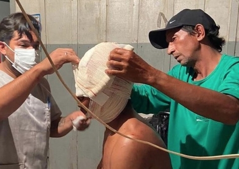 Indígena tem afundamento de crânio durante ataque de onça; veja fotos