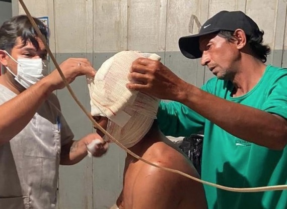 Indígena tem afundamento de crânio durante ataque de onça; veja fotos