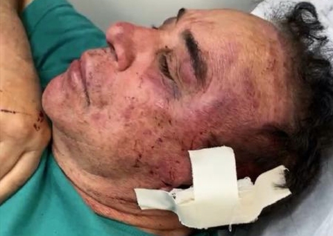 Candidato a prefeito tem casa invadida e é espancado por bandidos