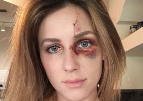 Brasileiro é condenado por espancar brutamente a namorada nos EUA