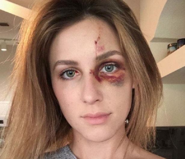 Brasileiro é condenado por espancar brutamente a namorada nos EUA