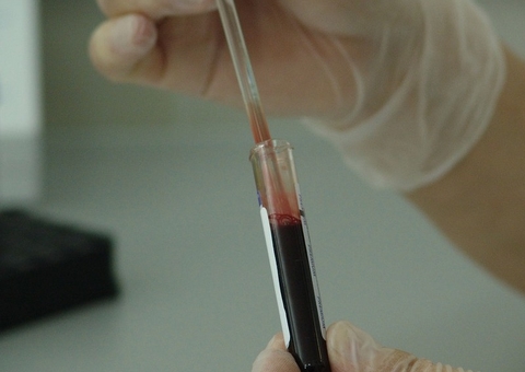 Anvisa suspende testes com plasma contra o coronavírus no Brasil