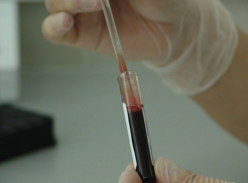 Anvisa suspende testes com plasma contra o coronavírus no Brasil