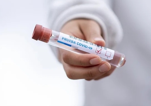 Brasil tem 6,57 milhões de casos e 176,6 mil mortes por Covid