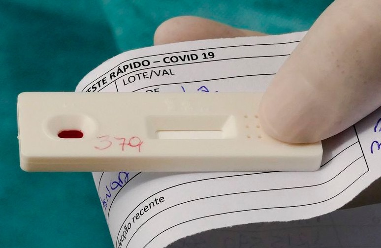 Dezenas de casos de reinfecção por Covid-19 são investigado no Brasil