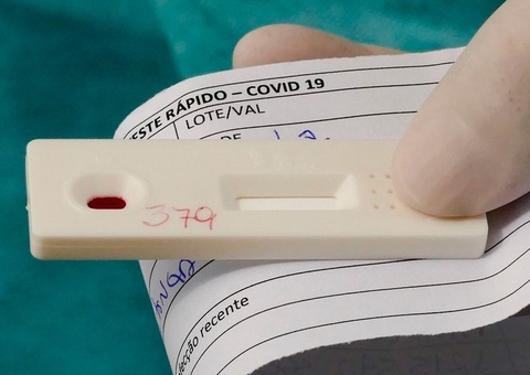 Dezenas de casos de reinfecção por Covid-19 são investigado no Brasil