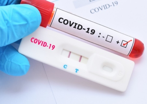 Procura por testes rápidos de covid disparam às vésperas do Natal