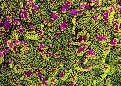 Covid: Pará confirma dois casos da variante amazônica no estado 