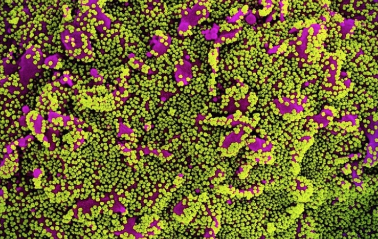 Covid: Pará confirma dois casos da variante amazônica no estado 