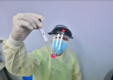 Brasil chega a 166 mil mortes e 5,8 milhões de casos de Covid-19