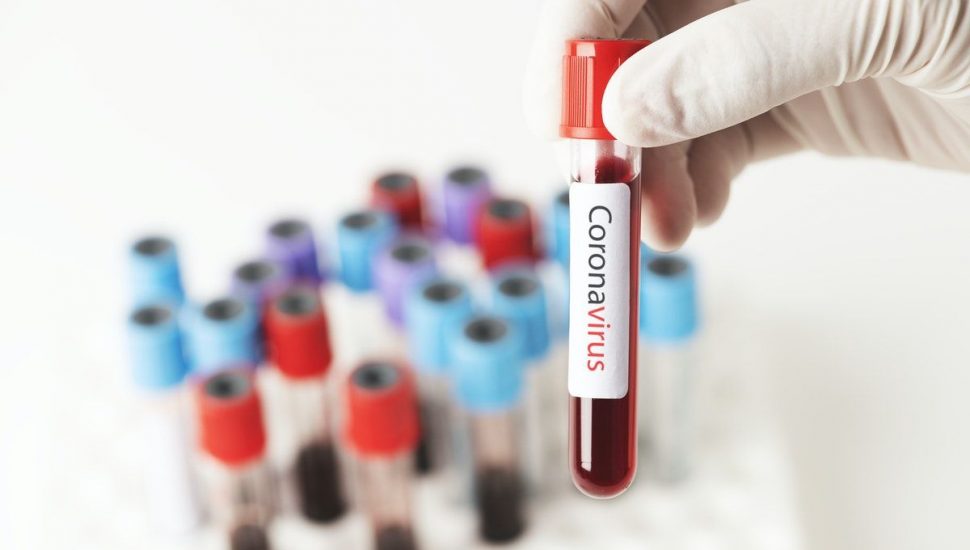 Brasil investiga mais de 90 casos suspeitos de reinfecção por coronavírus