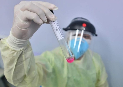 Brasil registra 24.468 casos e 272 mortes por Covid-19 em 24 horas