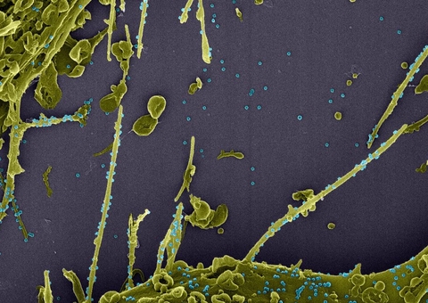 Segunda análise de variante do coronavírus no Brasil é divulgada