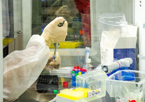 Covid-19: mortes somam mais de 228 mil e casos, 9,3 milhões