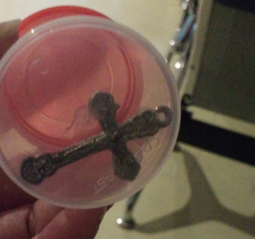Menino de 2 anos faz cirurgia para retirar crucifixo que engoliu