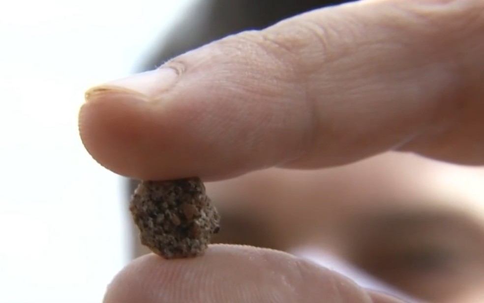 Menina de 3 anos coloca pedra no nariz e quase fica sem respirar 