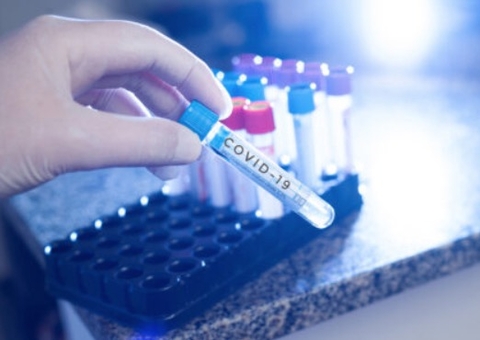 Amapá decide suspender campanha eleitoral após aumento de casos de covid-19