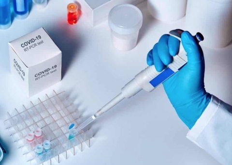 Câmara cobra providências sobre testes não distribuídos de Covid-19 